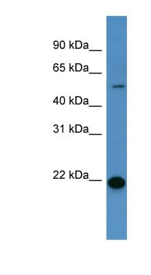 Polyclonal Rabbit anti-Human CD66d / CEACAM3 Antibody (aa177-226, WB)