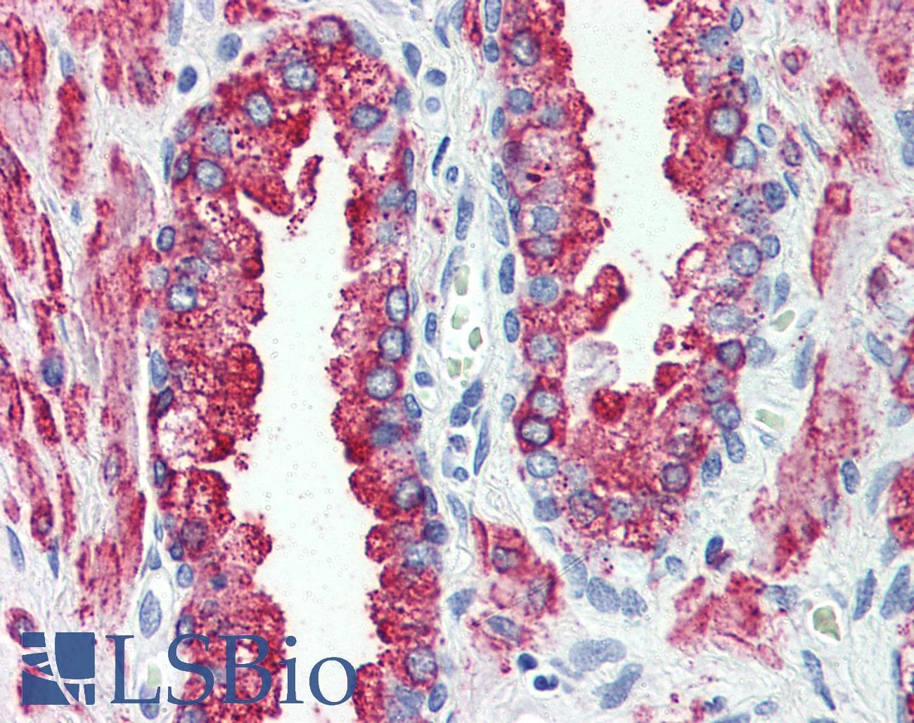 IHC-plus™ GPR146 Antibody (Internal)