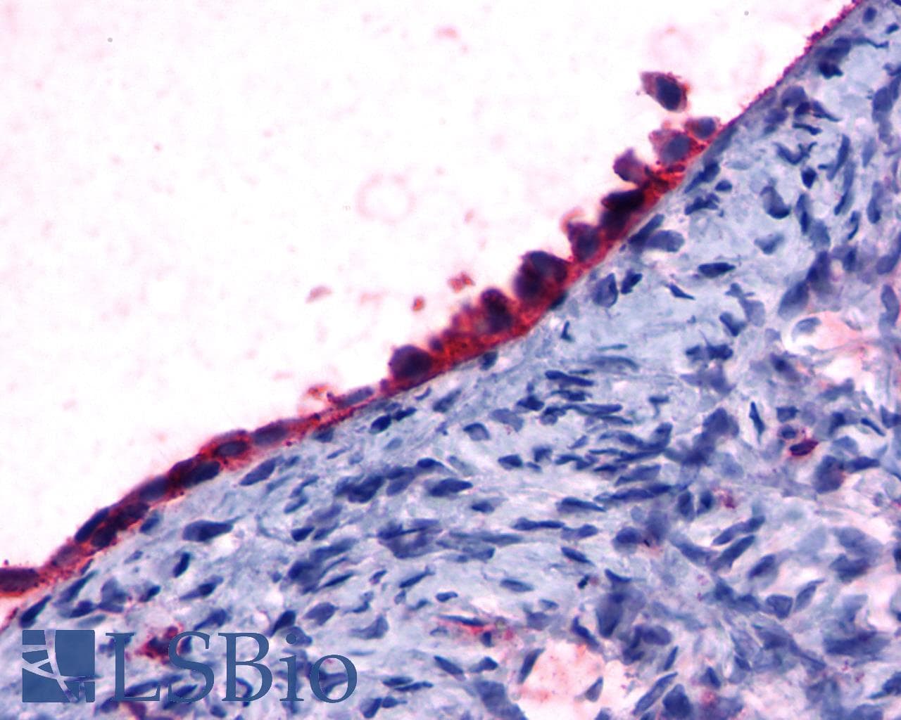 PathPlus™ GPR108 Antibody (Cytoplasmic Domain)