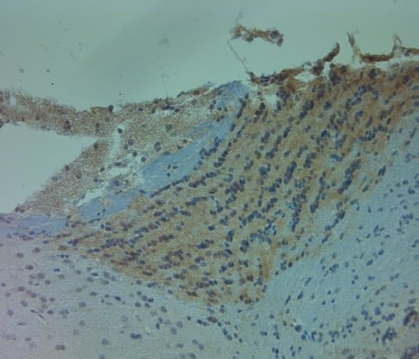 Polyclonal Rabbit anti-Human NOS1 / nNOS Antibody (aa1390-1434, IHC)