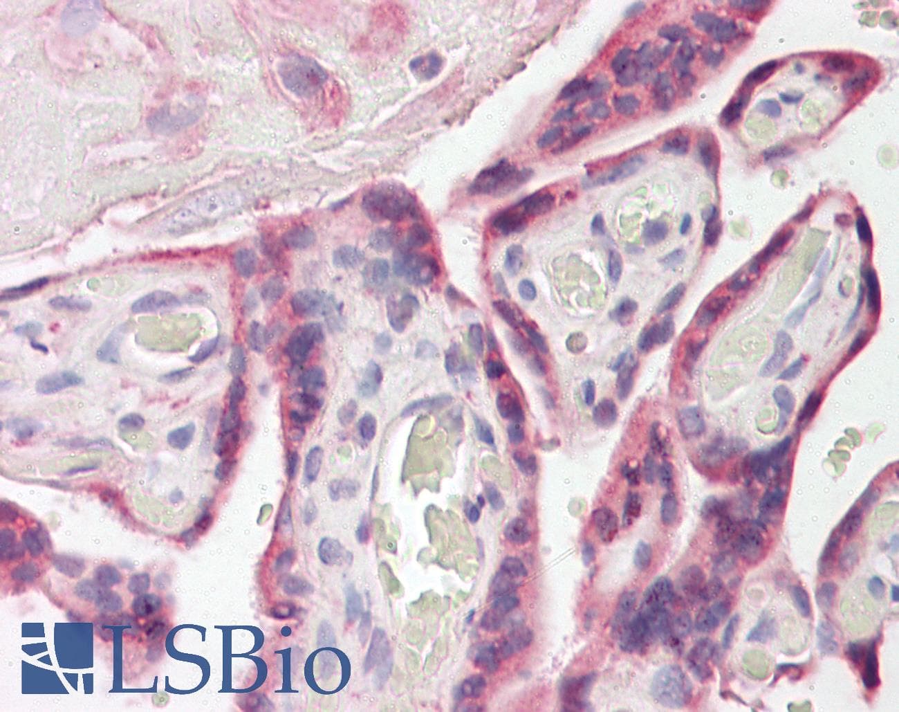 IHC-plus™ Polyclonal Goat anti-Human ESYT1 Antibody (aa1038-1050, IHC, WB)
