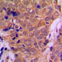 Polyclonal Rabbit anti-Human HDAC6 Antibody (C-Terminus, IHC, IF, WB)