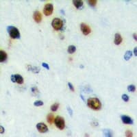 CABLES2 Antibody (Internal)