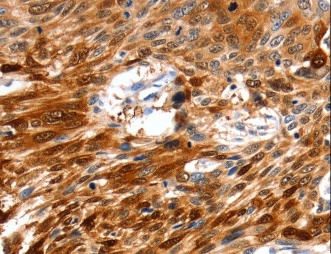 Polyclonal Rabbit anti-Human N-CoR / NCOR1 Antibody (IHC)