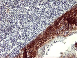 PDGFRB / PDGFR Beta Antibody (clone OTI1E8, Carrier-free)
