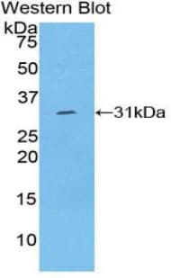 LAMC1 / Laminin Gamma 1 Antibody (aa1283-1551)