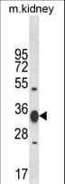 ACY3 Antibody (aa66-95)