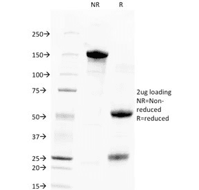 TROP2 / TACSTD2 Antibody (clone TACSTD2/2151)