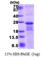 Human (CYREN) C7orf49 Protein (Recombinant His)