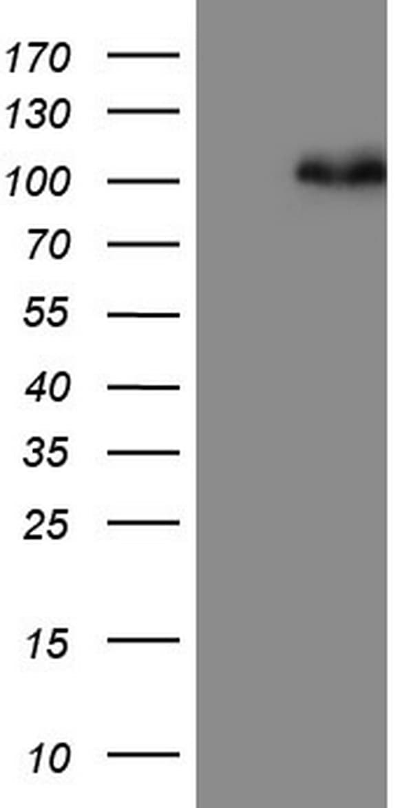 MDM2 Antibody (aa119-438, clone OTI3F1)