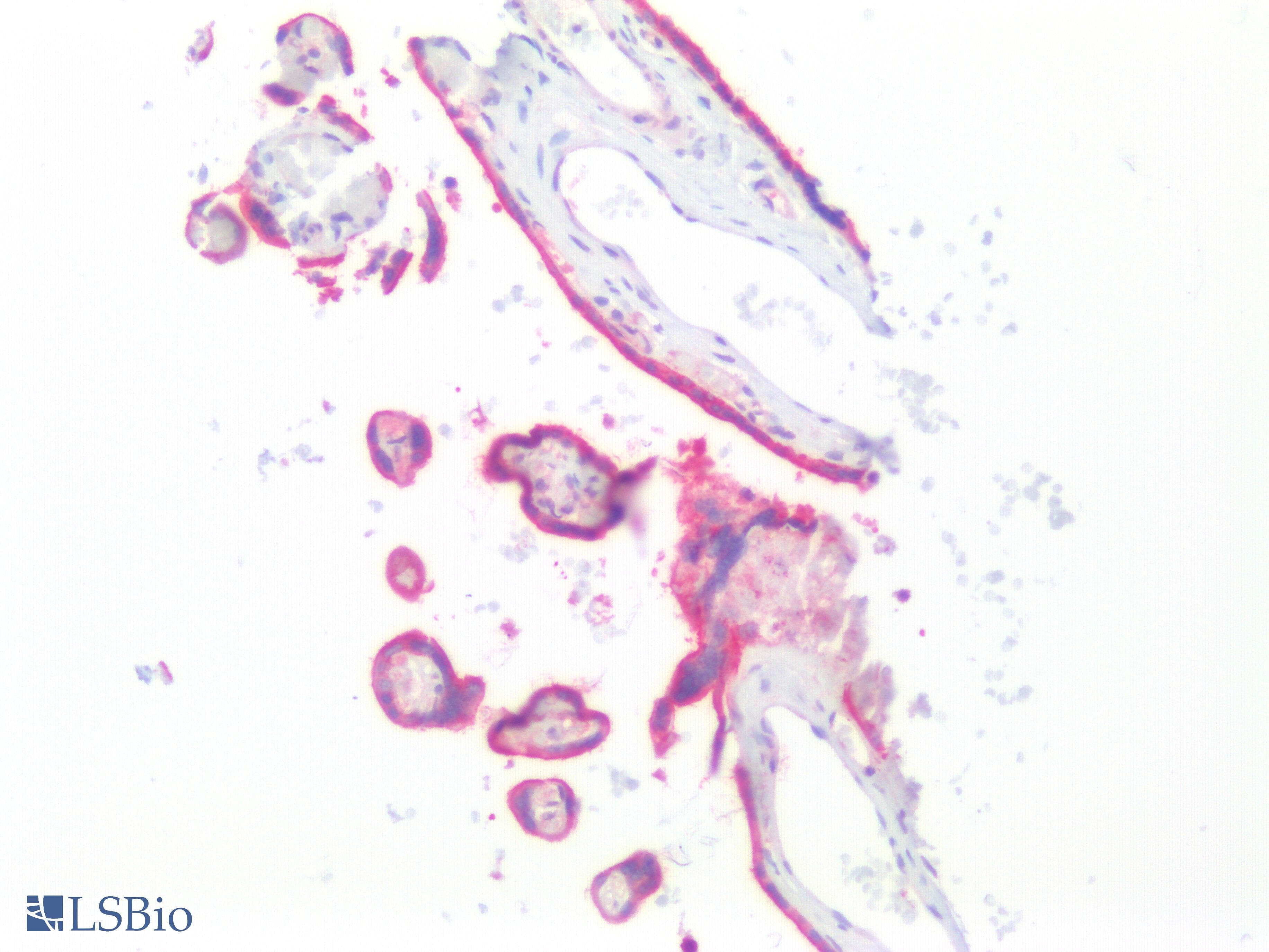 IHC-plus™ EGFR Antibody (Internal)
