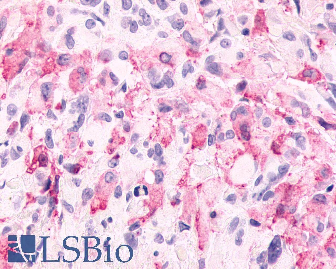 PathPlus™ GRM6 / MGLUR6 Antibody (N-Terminus)