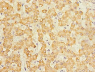 CLEC1B / CLEC-2 Antibody