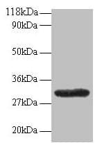 Polyclonal Rabbit anti-Human GPR161 Antibody (IHC, WB)