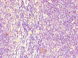 CD32B Antibody