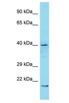 ZNF286A Antibody (aa227-276)
