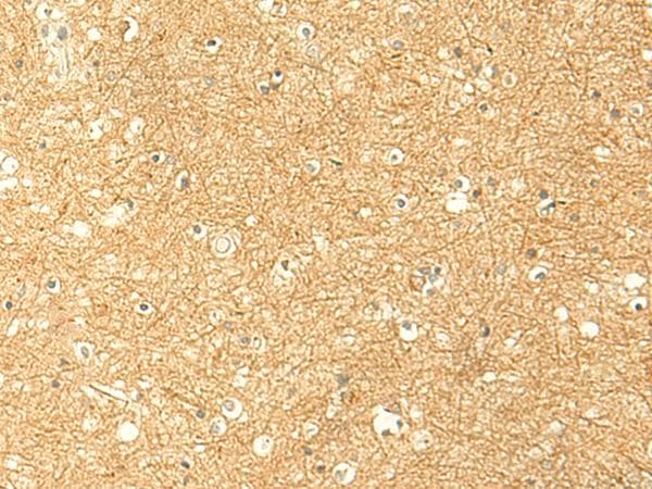 RNF148 Antibody