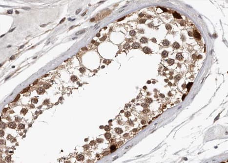 MYB / c-Myb Antibody (phospho-Ser532)