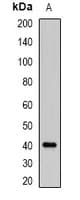 ABO Glycosyltransferase Antibody