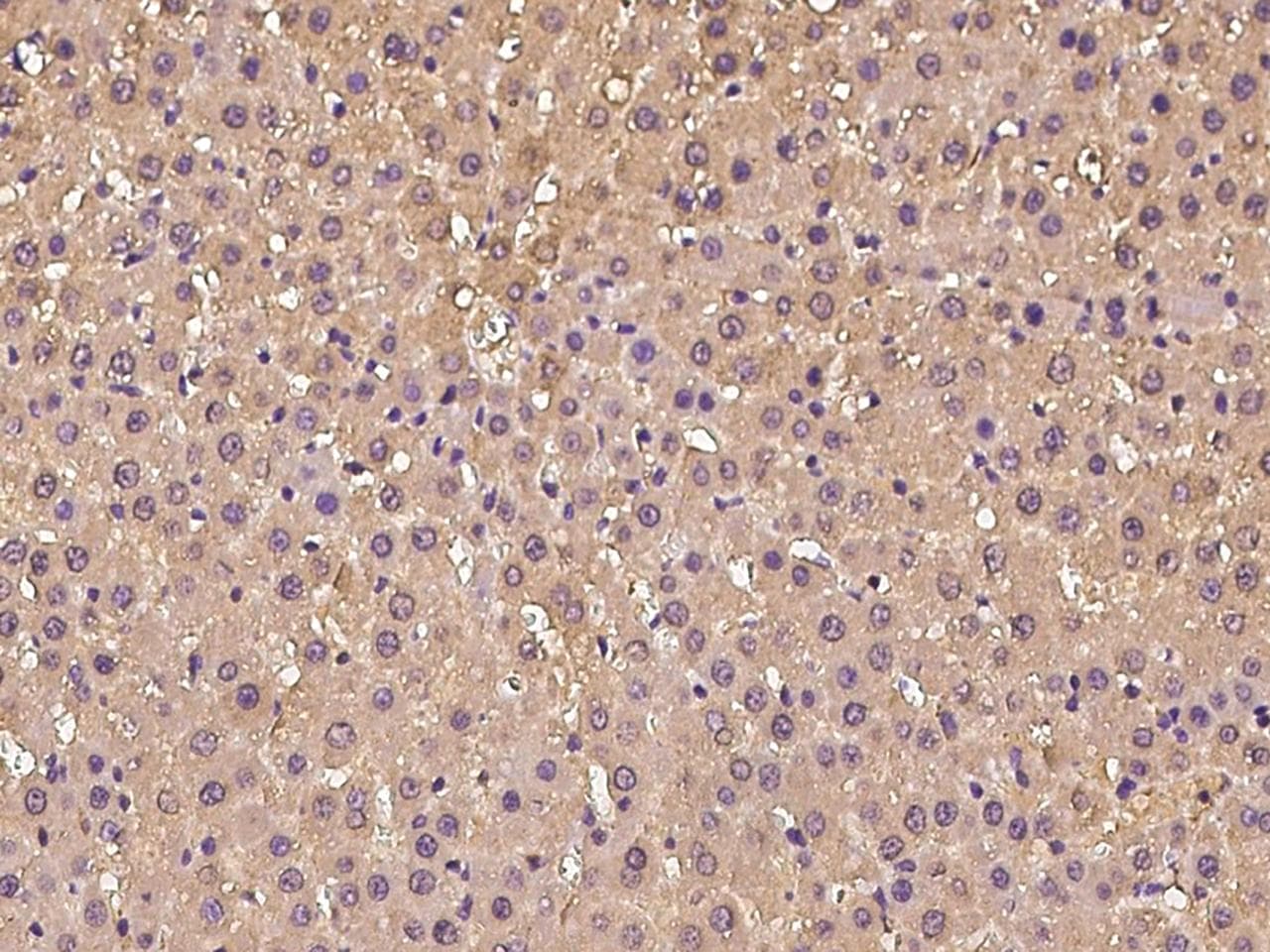 IL13RA2 / IL13R Alpha 2 Antibody (Preservative Free)
