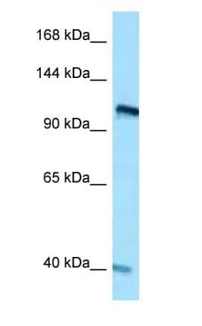 Polyclonal Rabbit anti-Human RET Antibody (aa867-916, WB)