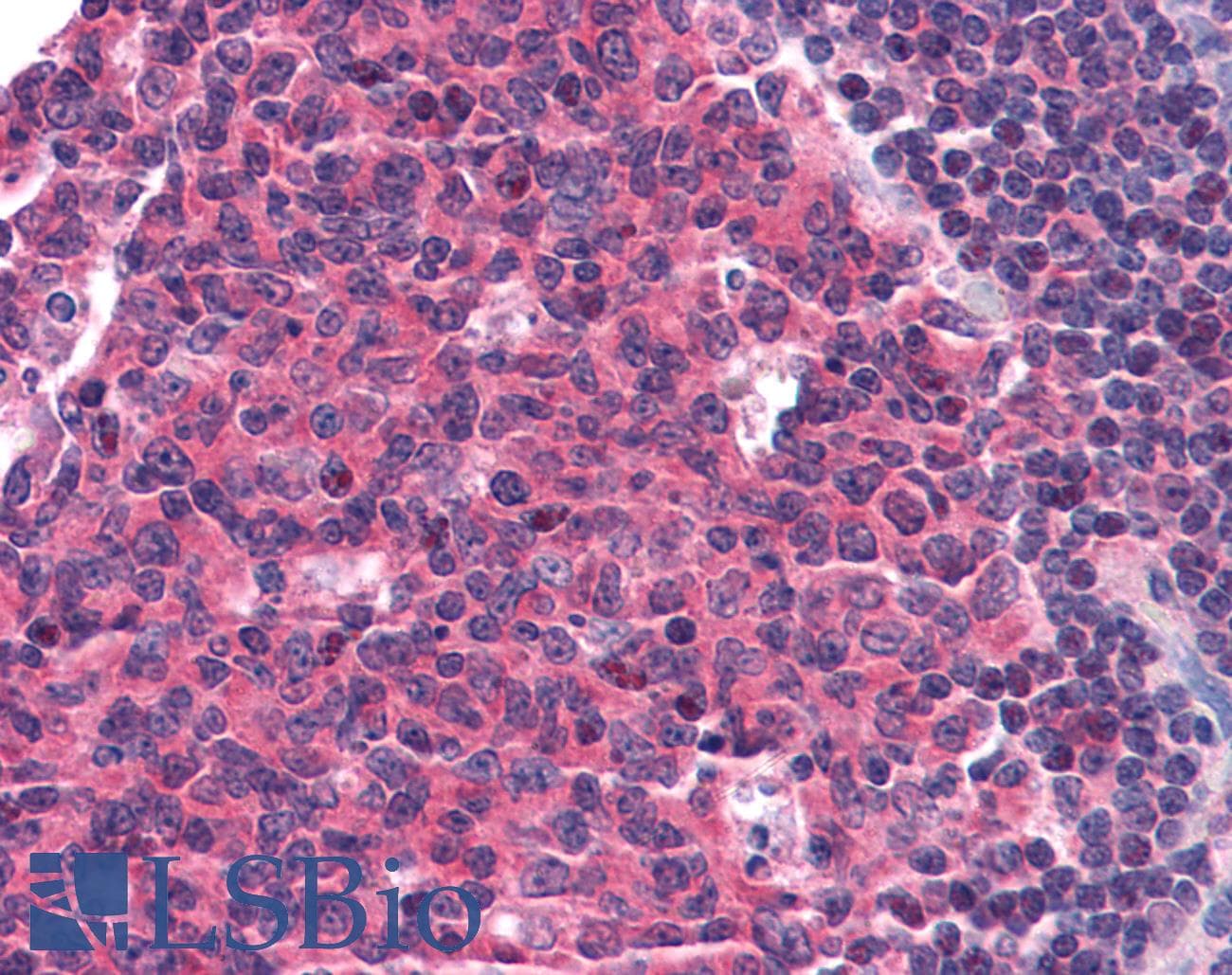 IHC-plus™ CCR5 Antibody (clone T21/8)