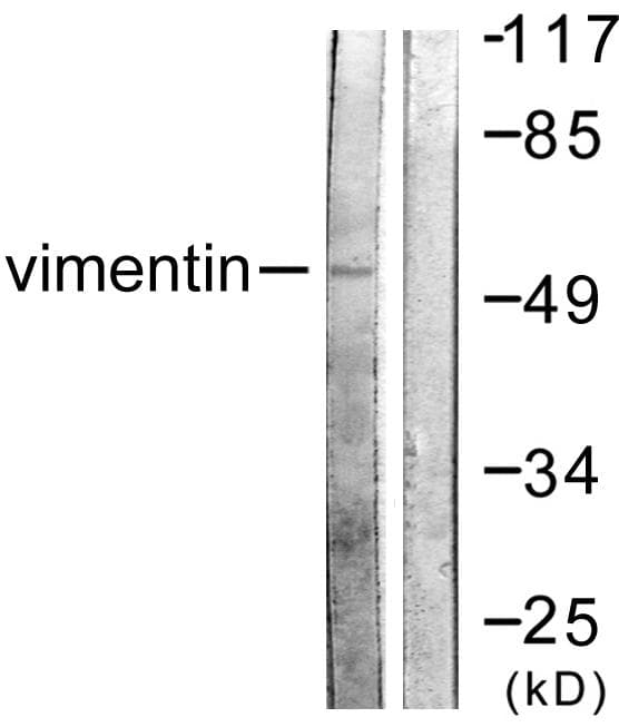 Vimentin Antibody