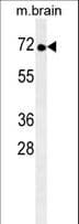 TNK1 Antibody