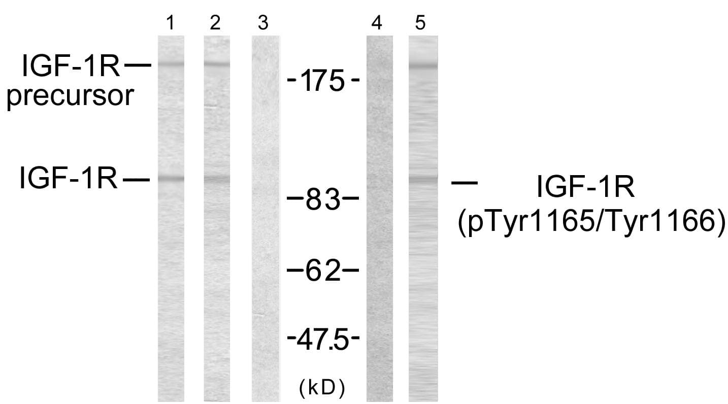 IGF1R / IGF1 Receptor Antibody (p1165/1166)