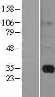 RASL11B Protein (Over-Expression Lysate Myc-DDK (Flag))