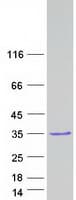 Human VCX2 Protein (Recombinant Myc-DDK (Flag))