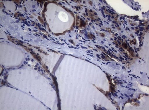 CTSL / Cathepsin L Antibody (clone OTI8H2)