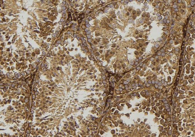Polyclonal Rabbit anti-Human GLUL / Glutamine Synthetase Antibody (IHC, IF, WB)