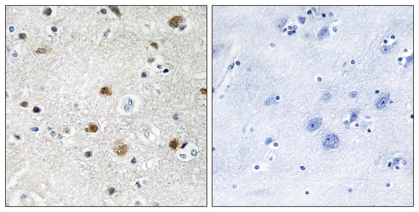 BRF1 Antibody