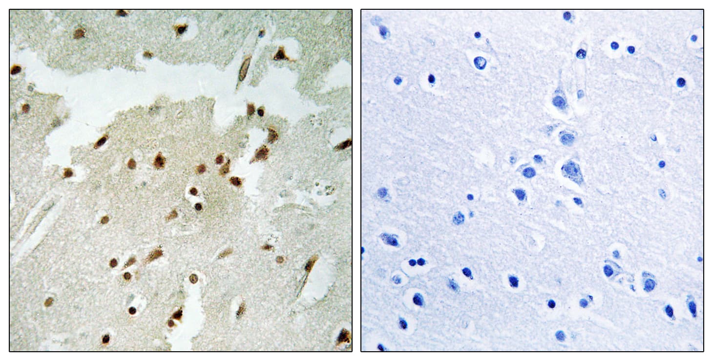 XRCC6 / Ku70 Antibody (phospho-Ser5)