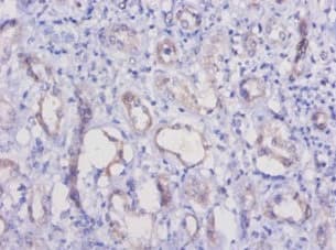 Polyclonal Rabbit anti-Mouse HAVCR1 / KIM-1 Antibody (IHC)