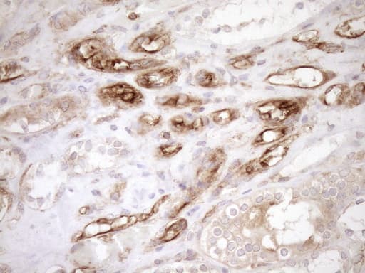 Monoclonal Mouse anti-Human ASPDH Antibody (clone OTI4G8, IHC)