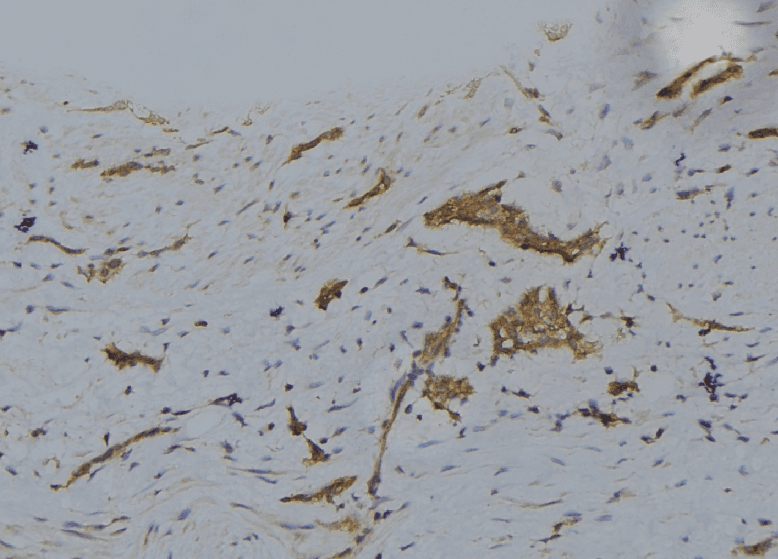 LATS1 Antibody