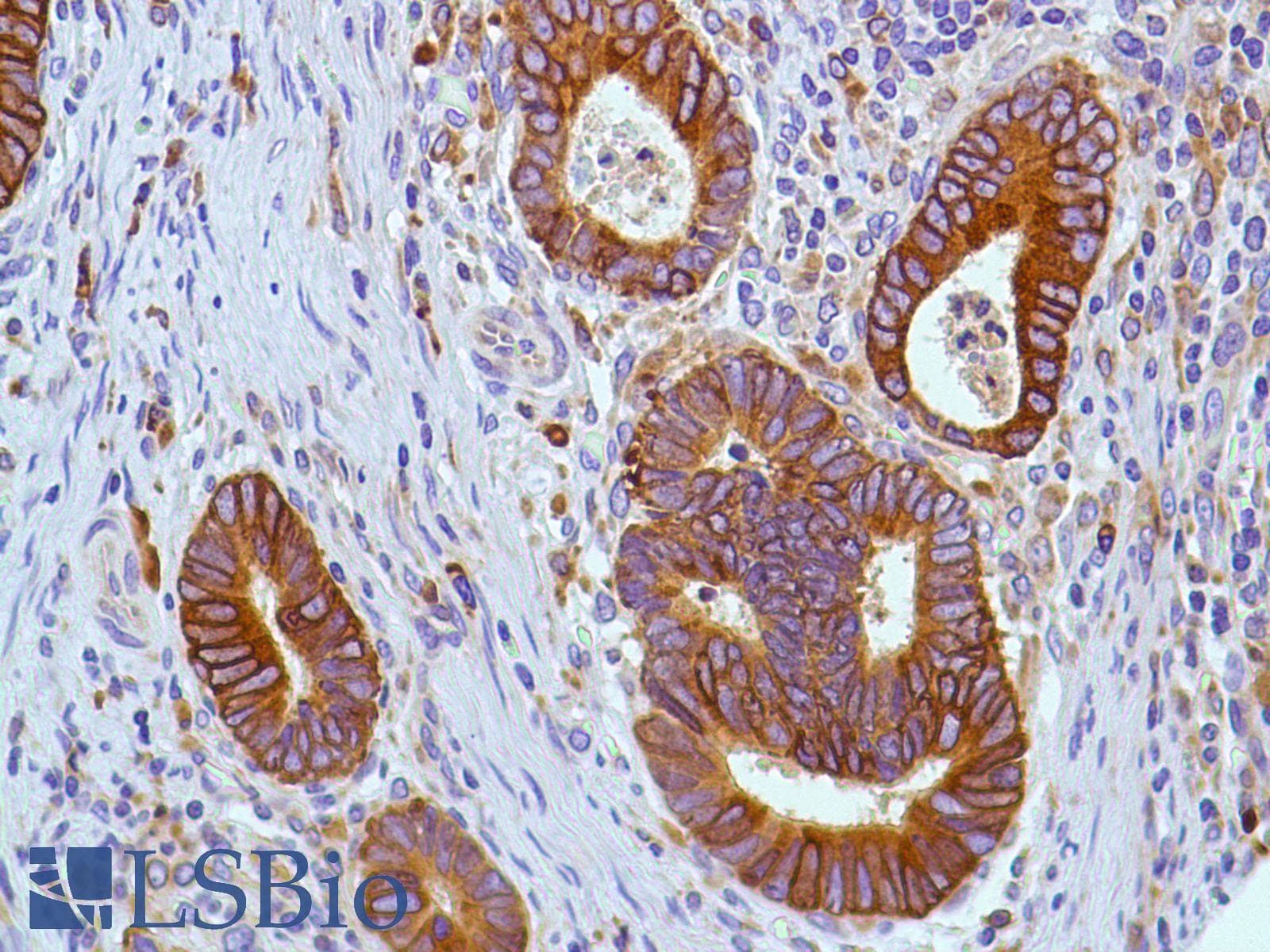 PTGS2 / COX2 / COX-2 Antibody (C-Terminus, clone SP21)