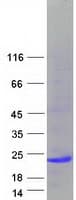 Human IL-10 Protein (Recombinant Myc-DDK (Flag))