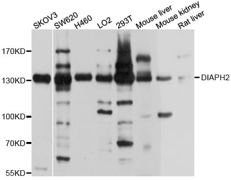 Polyclonal Rabbit anti-Human DIAPH2 Antibody (WB)