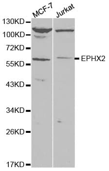 Polyclonal Rabbit anti-Human EPHX2 / Epoxide Hydrolase 2 Antibody (IHC, WB)