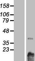 CHKB / CHKL Protein (Over-Expression Lysate Myc-DDK (Flag))