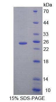 Mouse MOCS1 Protein (Recombinant His-T7)