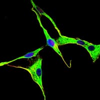 ADRBK1 / GRK2 Antibody (clone 3F8)