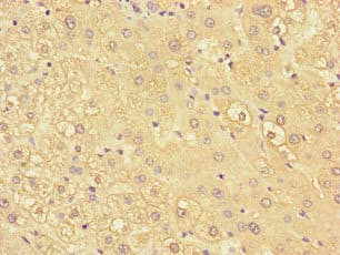 KIR2DL3 / CD152B2 Antibody