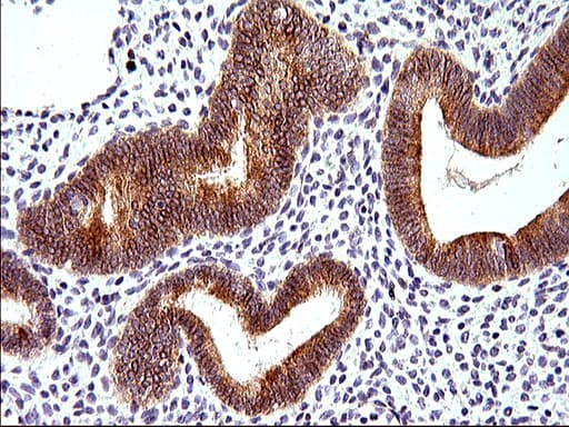 HERPUD1 / HERP Antibody (clone OTI1A2)