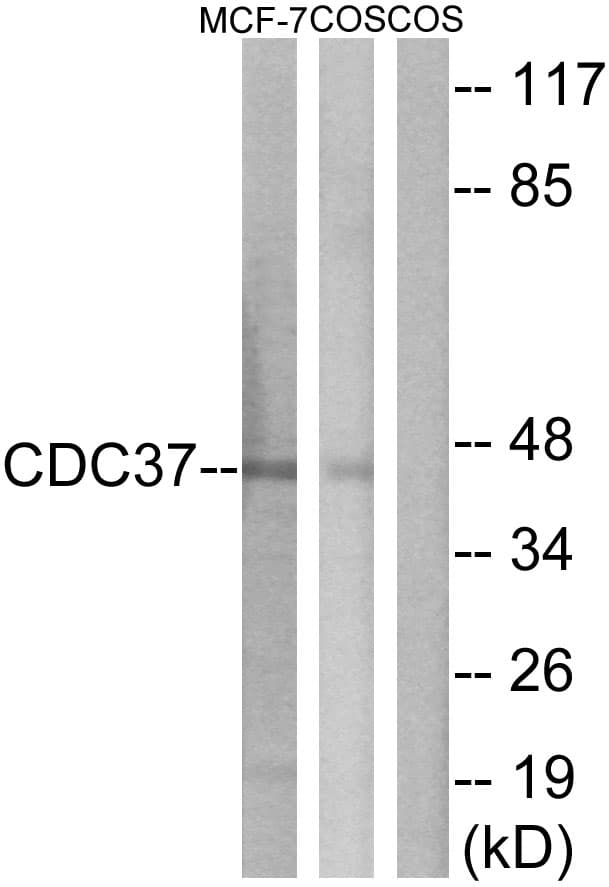 IHC-plus™ Polyclonal Rabbit anti-Human CDC37 Antibody (aa1-50, IHC, IF, WB)