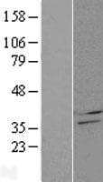 CBR4 Protein (Over-Expression Lysate Myc-DDK (Flag))