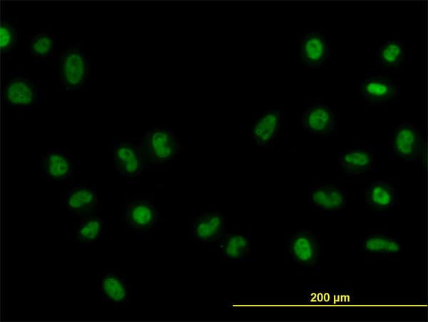 PathPlus™ FOXA1 Antibody (clone 3C1)